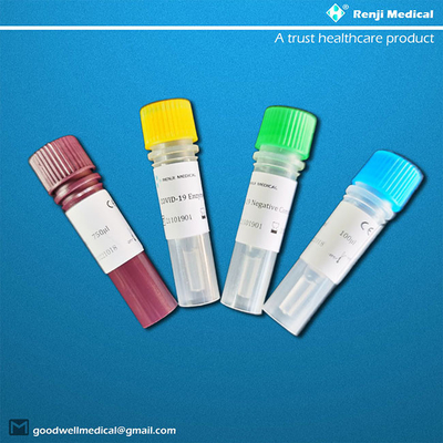 ชุดทดสอบกรดนิวคลีอิกแบบเรืองแสง RT-PCR Novel Coronavirus Test Rapid