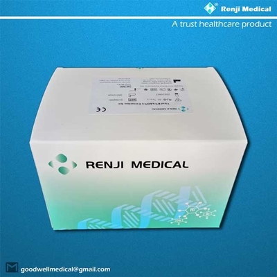 ชุดสกัดกรดนิวคลีอิก Renji, Magnetic Bead Viral Rna Purification Kit