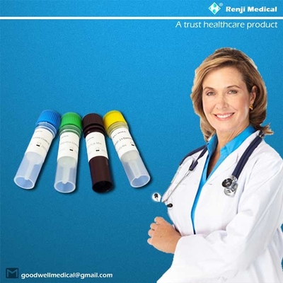 COVID-19 Novel Coronavirus Test Kit การทดสอบความจุสูง การอนุมัติ MA YBTC